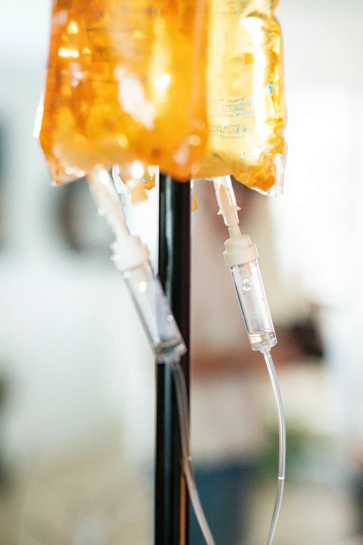 Close-up of an amber IV bag and its drip chambers hanging from an IV stand